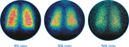 Alto flusso, erogazione di farmaci efficace